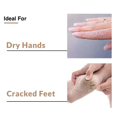 Fixderma Skincare Dry Skin Spf 30+ Cream